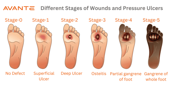 The Science of Advanced Wound Management